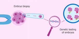 preimplantation genetic diagnosis