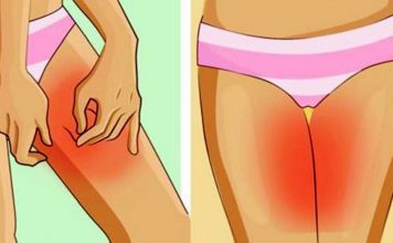 vaginal chafing