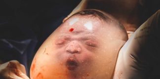 En Caul Birth