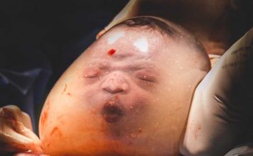 En Caul Birth