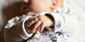 anencephaly in babies