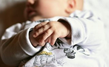 anencephaly in babies
