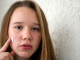 teenage acne