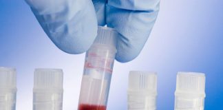tissue banking