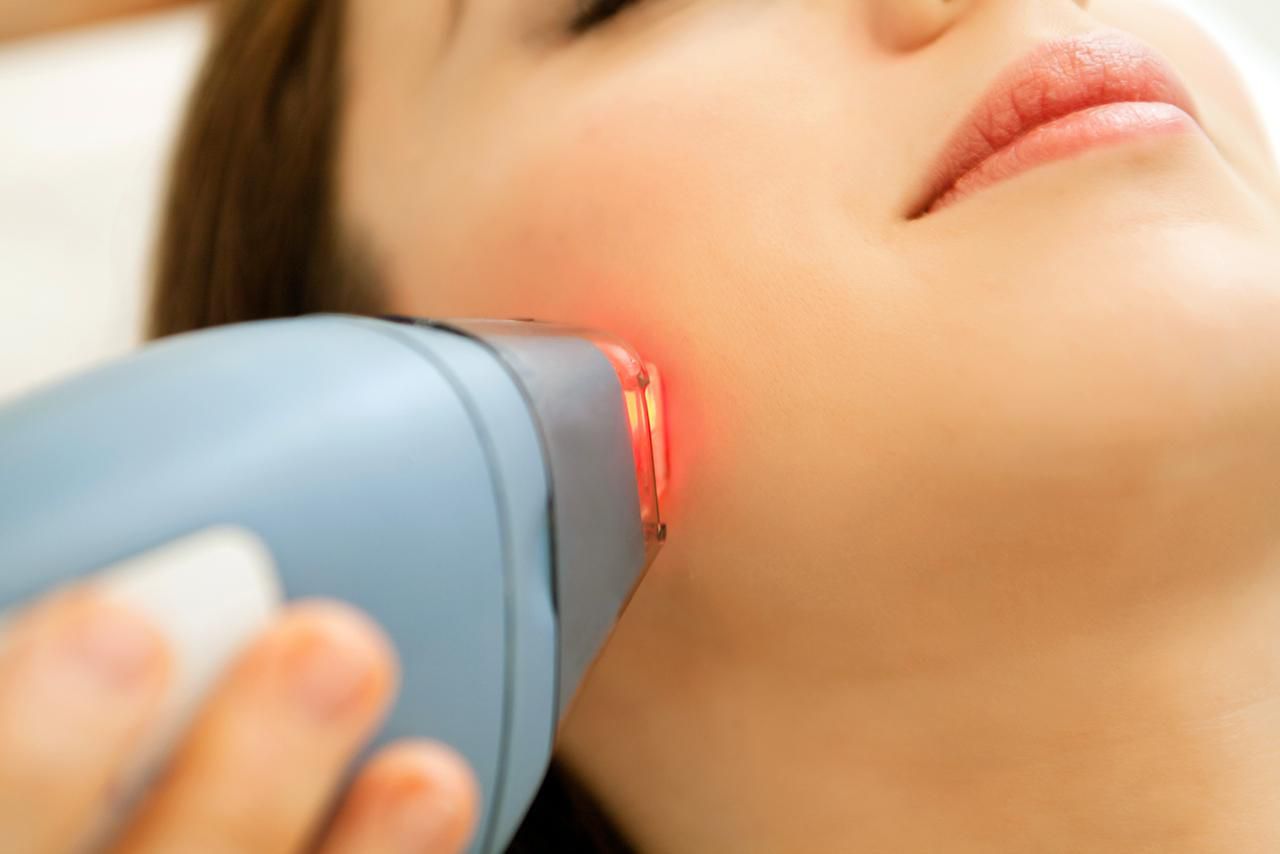 laser treatment for face