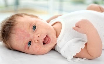 allergic foods for babies