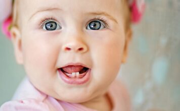 delayed teething in babies