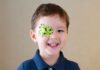 periorbital cellulitis in children