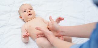 umbilical hernia in babies